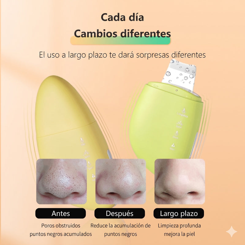 Belleza Limpiador Exfoliante Ultrasónico JY-2519 - Piel Limpia y Sin Puntos Negros en Ecuador de Tendeli Ecuador en