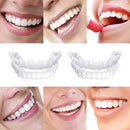 Belleza Carillas Dentales Temporales Ecuador - Snap On Smile Dientes Perfectos Sin Dentista de Tendeli- Ecuador en